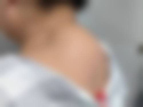 五、东莞市星辰花医疗美容门诊价格表