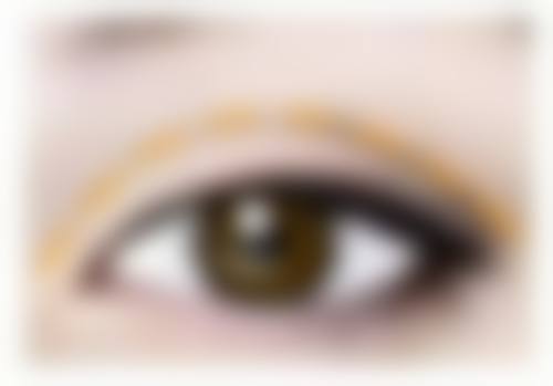 六、疤痕增生的处理方法