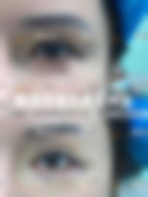 六、李猛真实的患者评价