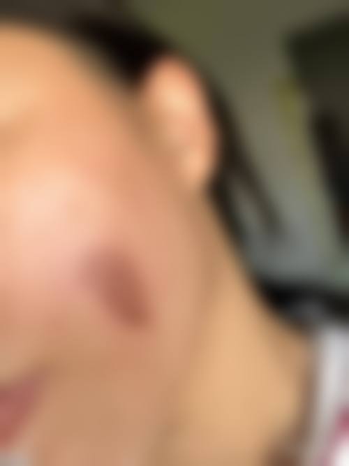 七、深圳派壹特医疗美容门诊部预约方式