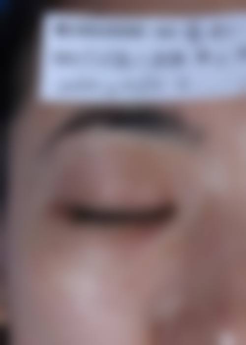 二、东莞市星辰花医疗美容门诊怎么样？