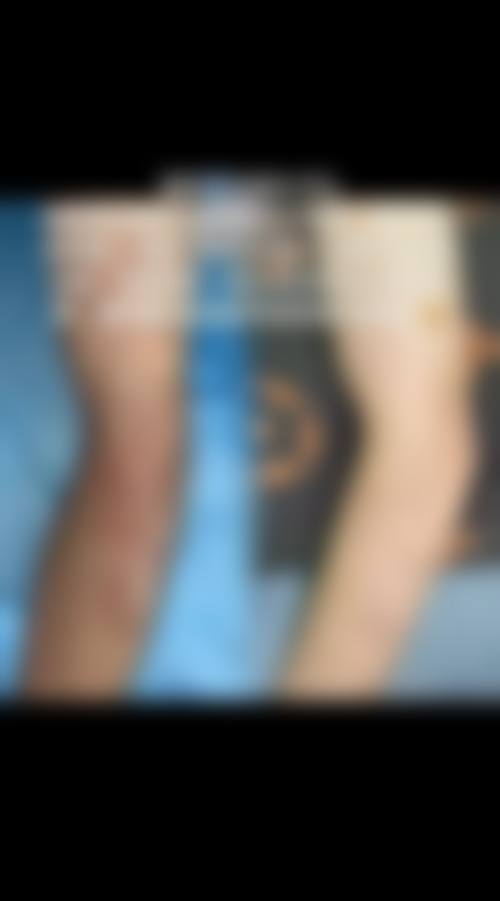 五、深圳派壹特医疗美容门诊部价格表