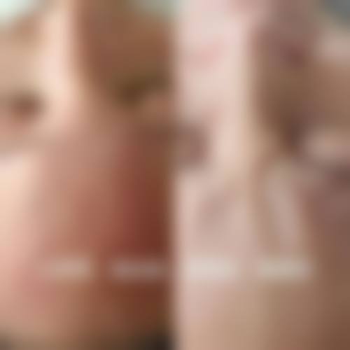 二、深圳派壹特医疗美容门诊部怎么样?