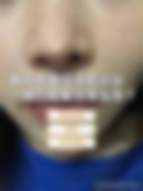 四、李猛收费价格表