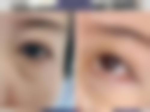 四、深圳派壹特医疗美容门诊部特色项目