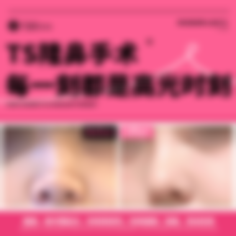 三、轻医美去除结构性眼袋方案