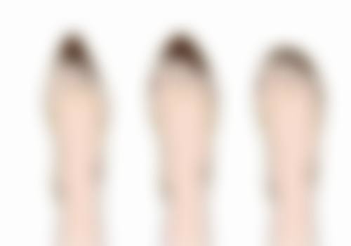 三、不同时间段取出假体的情况