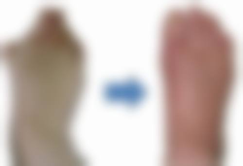 假体隆胸多久能取出？因人而异理性看待