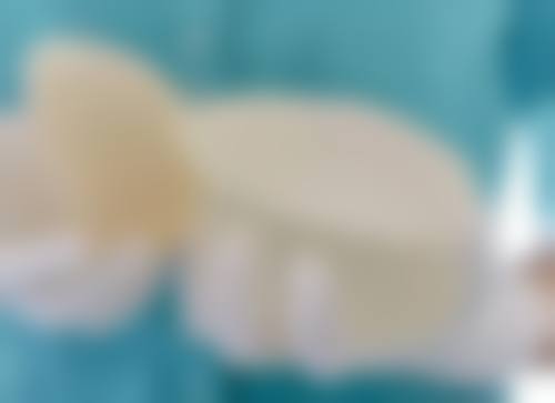 一、怎么消除眼袋成效好之了解眼袋类型