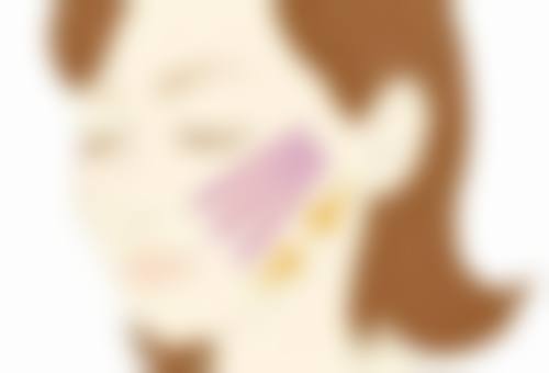 四、点痣留下的疤痕的其他治疗方式