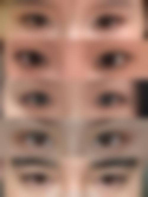 四、阜阳市琴瑟医疗美容门诊部特色项目