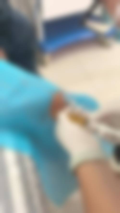 三、普洱悦她婕熹卡医疗美容诊所诊疗项目有哪些？