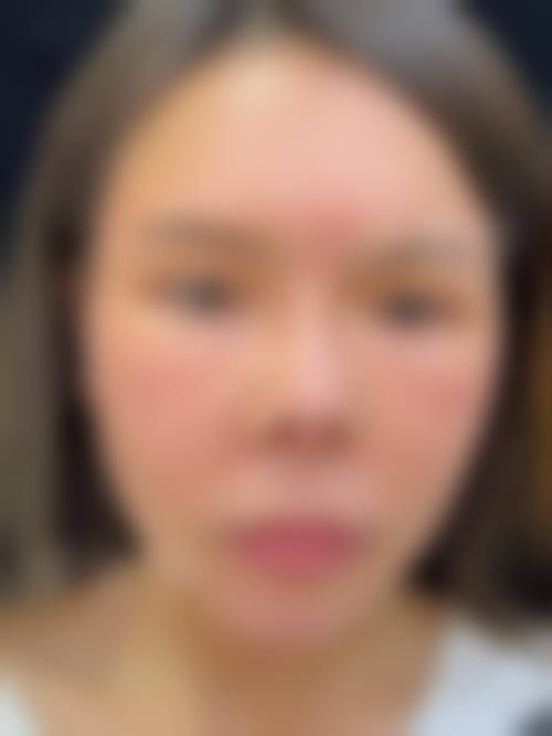 三、楚雄壹心医疗美容诊所诊疗项目有哪些？