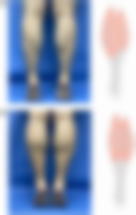 八、楚雄壹心医疗美容诊所真实的患者评价