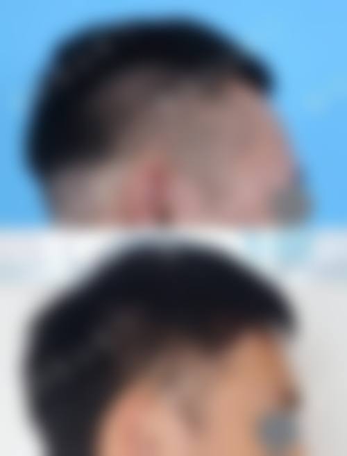 七、普洱悦她婕熹卡医疗美容诊所预约方式