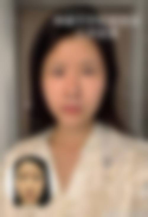八、普洱悦她婕熹卡医疗美容诊所真实的患者评价