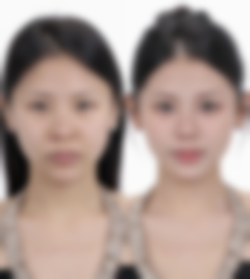 二、怎么消除眼袋成效好之日常护理方法