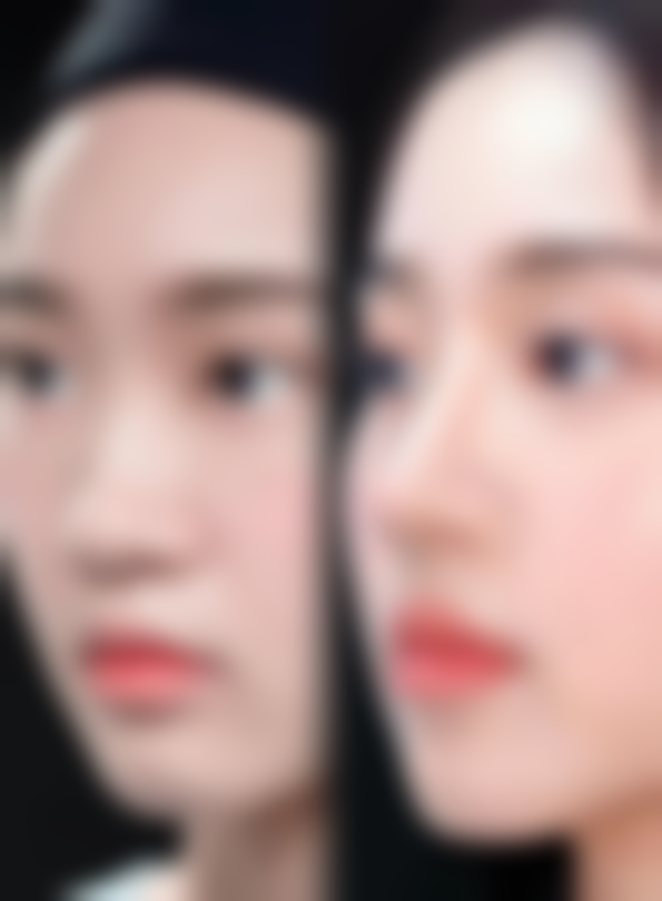 八、北京伟力·圣韩美医疗整形美容医院真实的患者评价