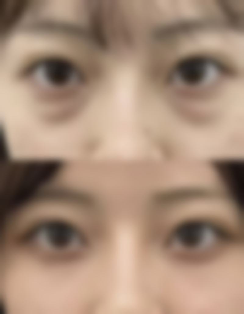 九、西安俏美人医疗美容诊所真实的患者评价