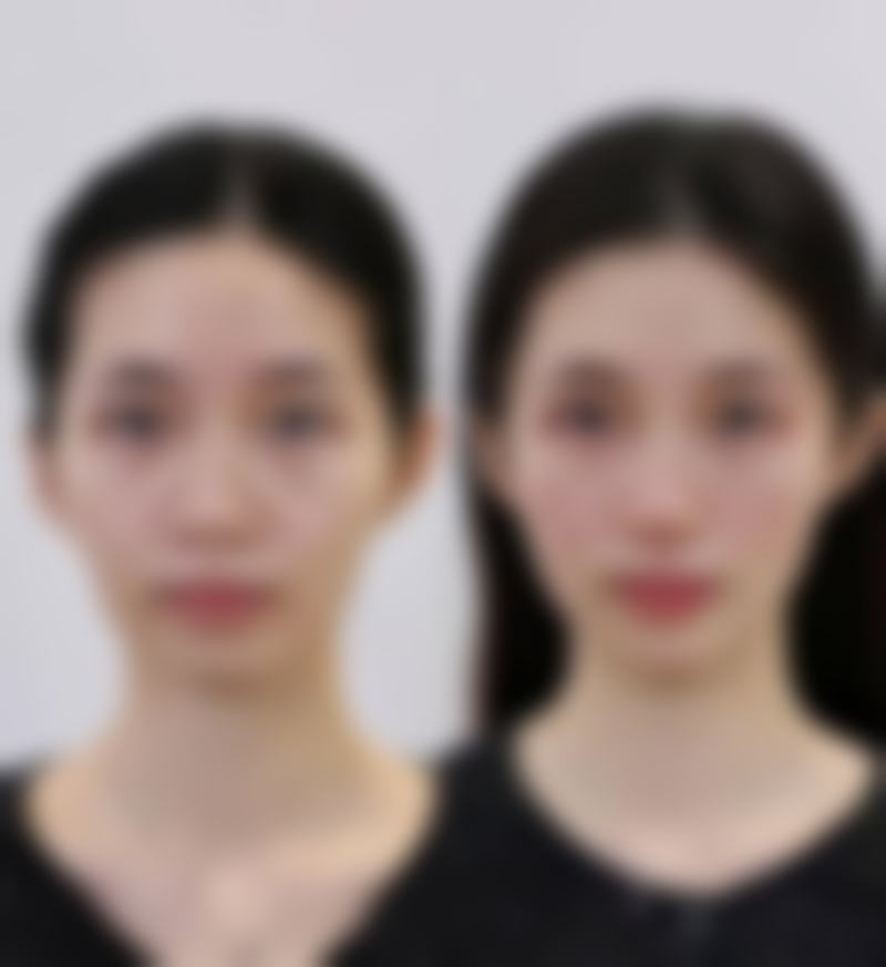 五、北京伟力·圣韩美医疗整形美容医院价格表