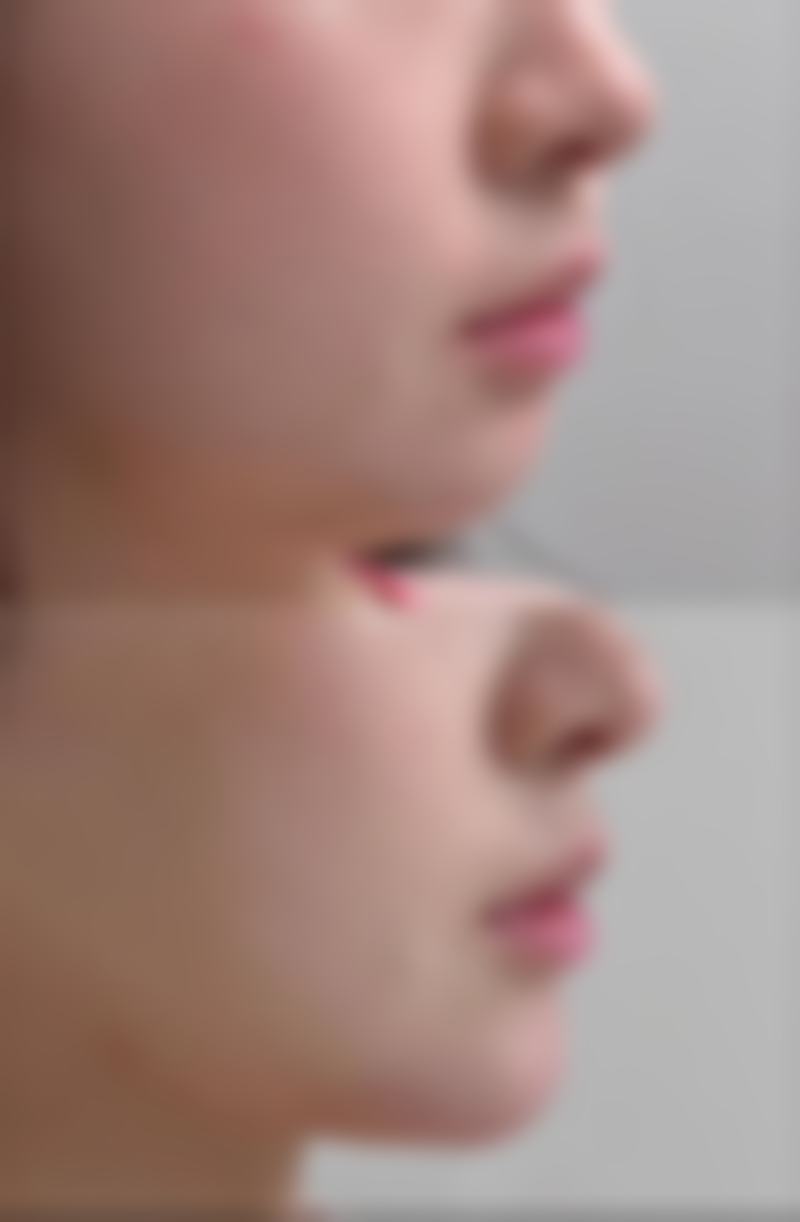 六、怎么消除眼袋成效好之日常维护与风险提示