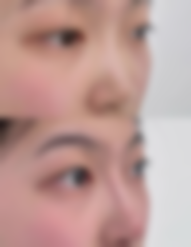 八、上海德琳医疗美容医院实例及口碑