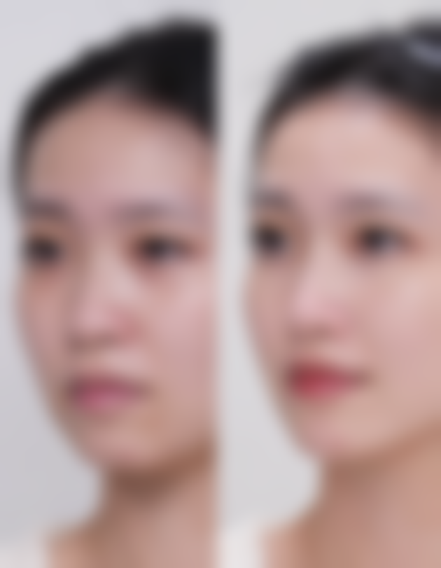 二、点痣留下的疤痕的日常护理方法