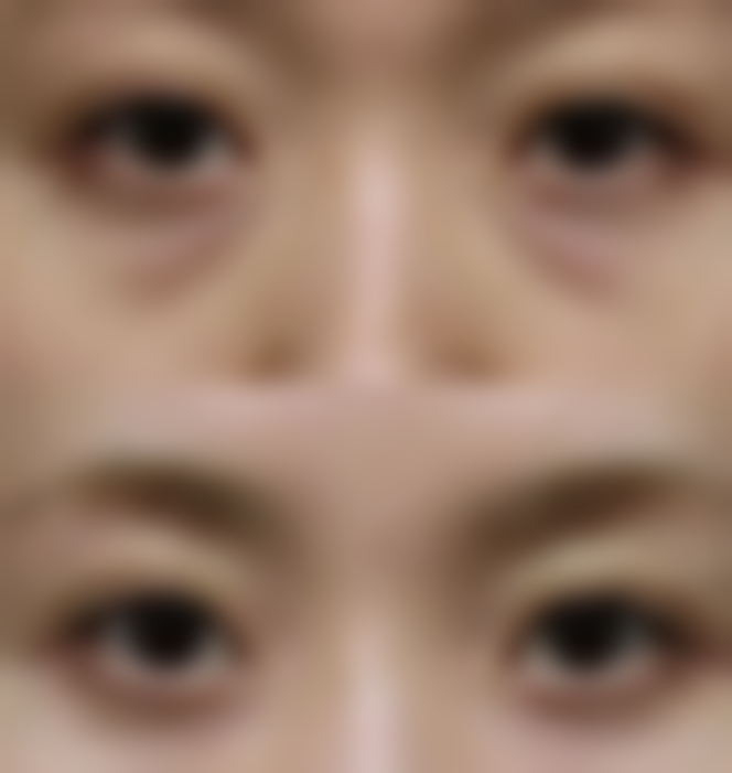 三、日常护理方法对去眼袋的作用