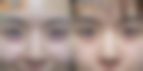 四、手术风险及应对措施