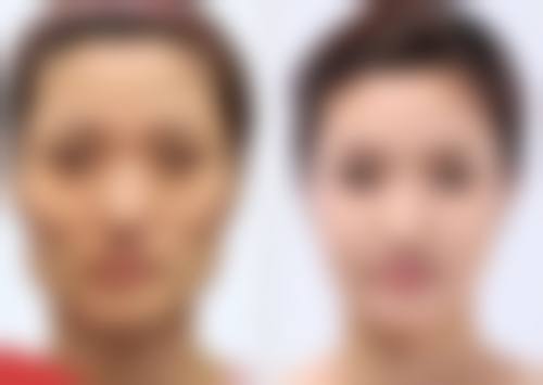 三、做双眼皮去美容院可以吗？美容院与正规医疗机构的对比