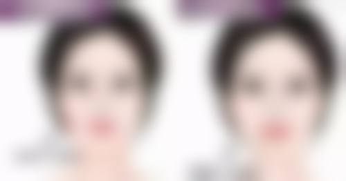 五、吸脂手术有成效吗——正确看待理性选择