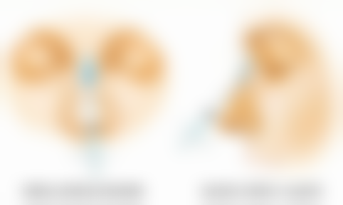 二、做双眼皮去美容院可以吗？美容院操作双眼皮的主要风险