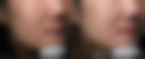 八、南宁丽美医疗美容门诊部真实的患者评价