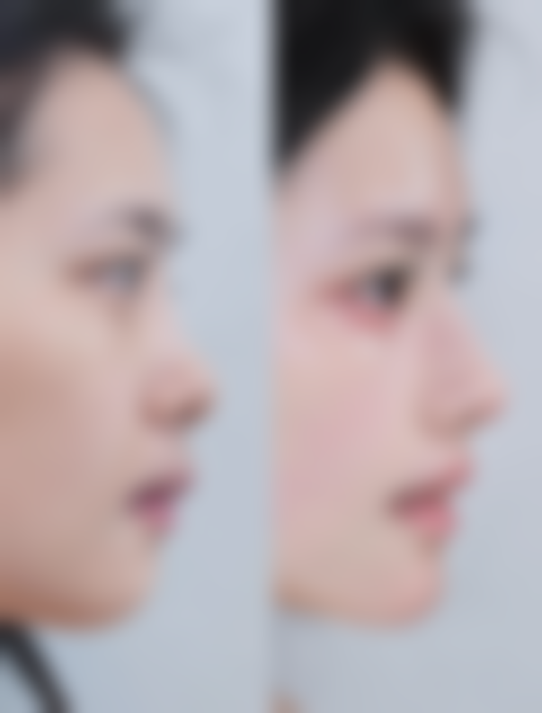 九、南昌优术医疗美容门诊部真实的患者评价