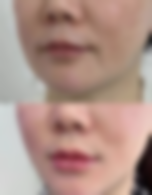 三、南昌优术医疗美容门诊部诊疗项目有哪些？