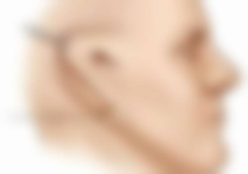 二、止痒的临时缓解方案