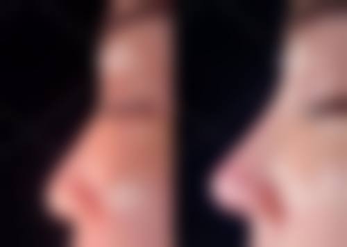 三、镇江晶悦整形医疗美容门诊部诊疗项目有哪些?