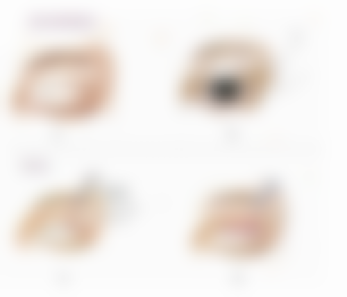 二、辅助护理建议