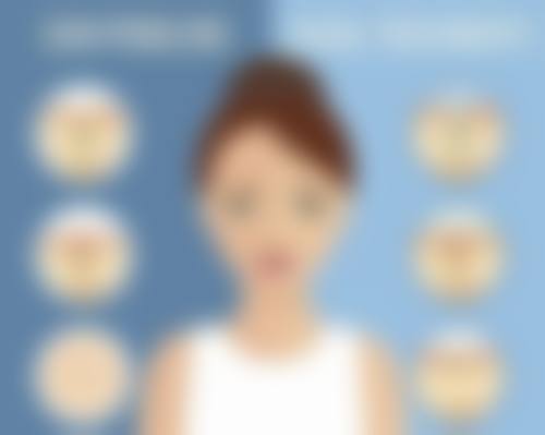 二、切眼袋疤痕增生的分级评估