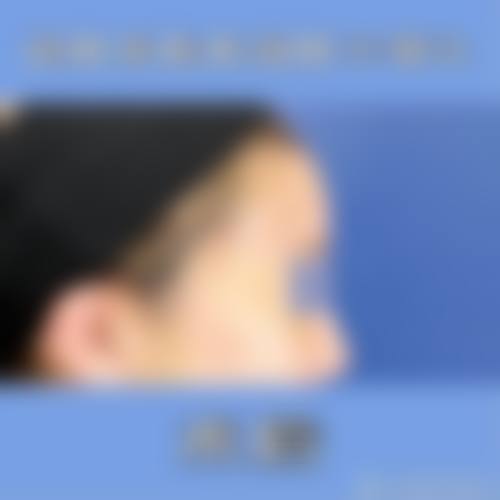 九、镇江晶悦整形医疗美容门诊部真实的患者评价