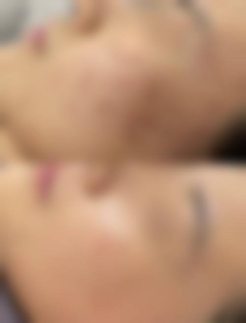 四、普洱云美妇产医院医疗美容科特色项目