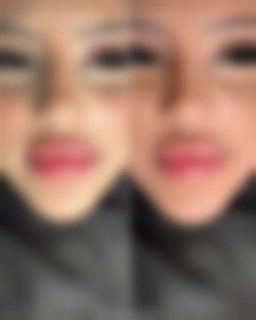 三、普洱云美妇产医院医疗美容科诊疗项目有哪些？