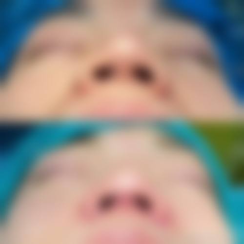 八、普洱云美妇产医院医疗美容科真实的患者评价