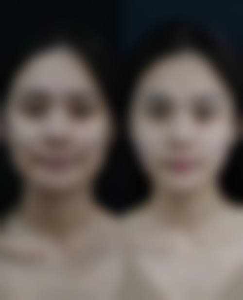 七、海口唯美馨美容医院预约方式