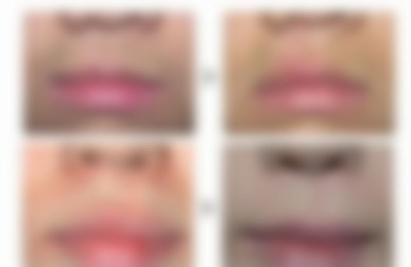 三、李树芝技术优势