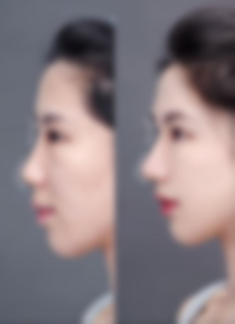 七、普洱云美妇产医院医疗美容科预约方式