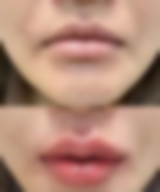 五、温州颐和医疗美容诊所价格表