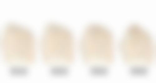 {子宫切除的疤痕怎么恢复快？综合护理与医学手段结合助你加速改善瘢痕状况 