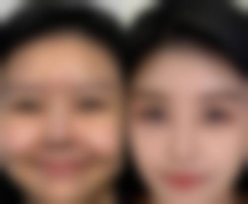 五、常见疑问解答