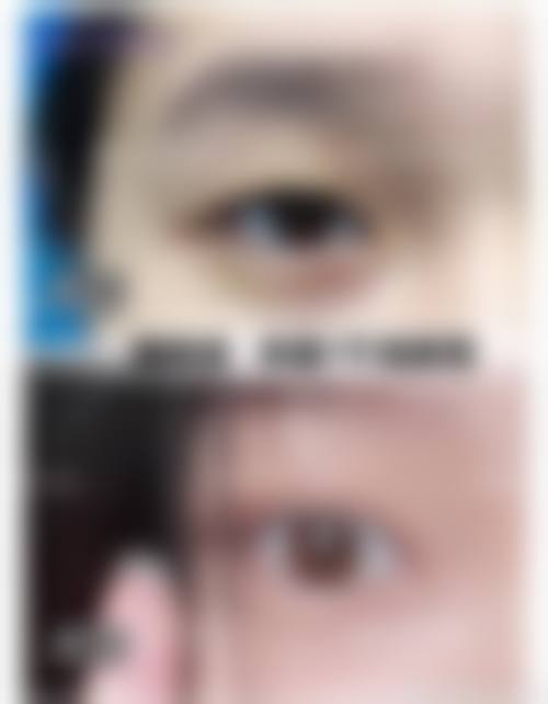 五、天津尔湾整形医院价格表